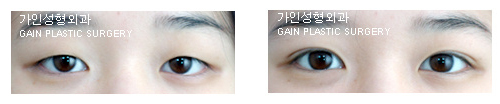 가인만의 매몰법!
