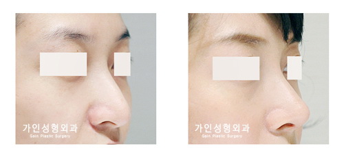 작고짧은코