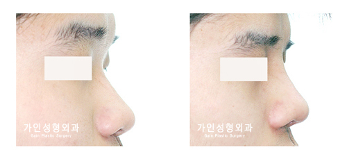 작고짧은코