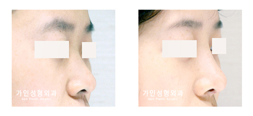 작고짧은코