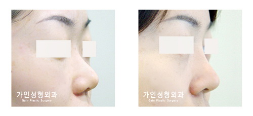 작고짧은코