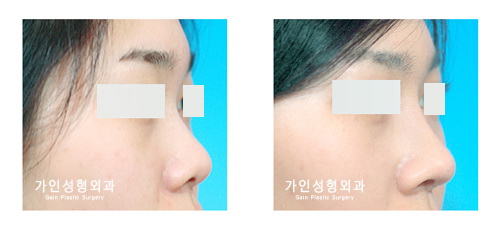 작고짧은코