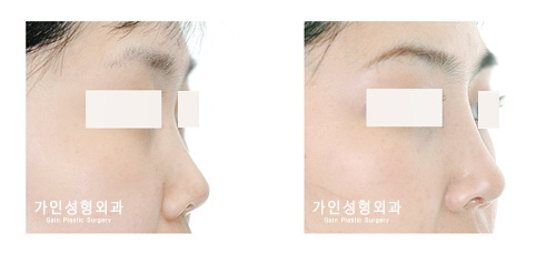 작고짧은코