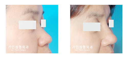 작고짧은코