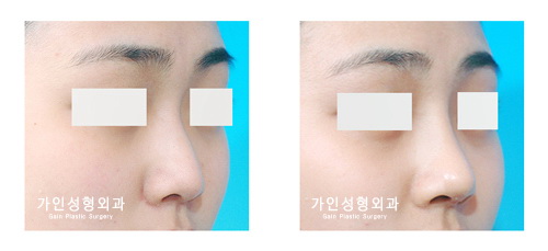 작고짧은코