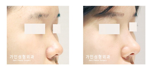 작고짧은코