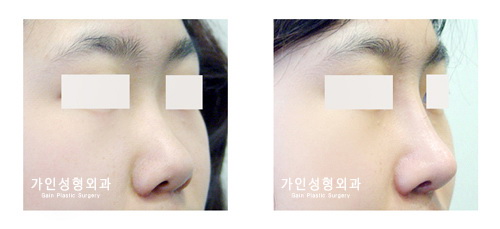 작고짧은코