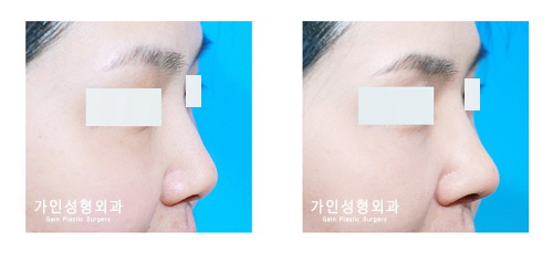 작고짧은코