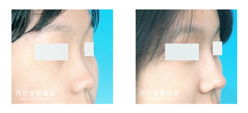 작고짧은코