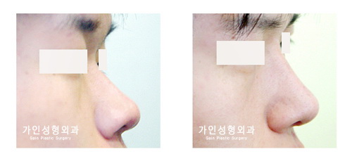 작고짧은코