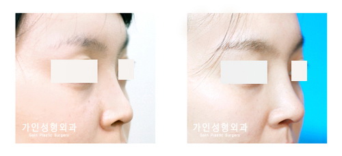 작고짧은코