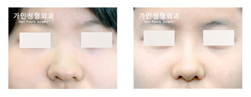복코