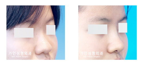 복코