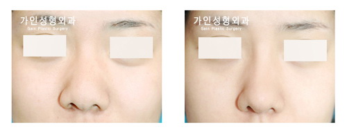 복코