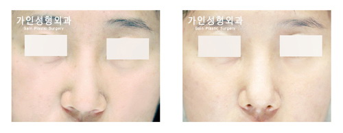 복코