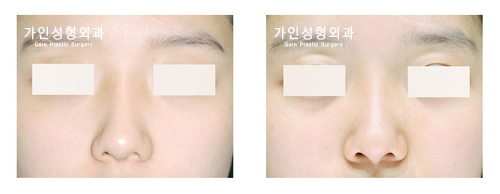복코
