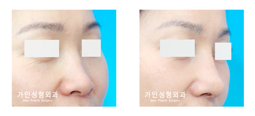 복코