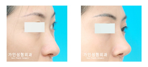 긴코-화살코