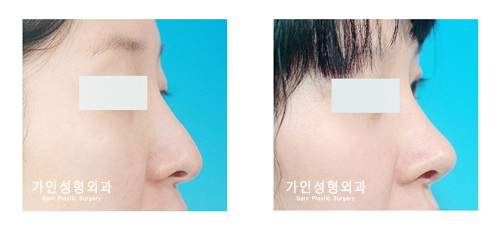 긴코-화살코