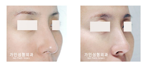 긴코-화살코