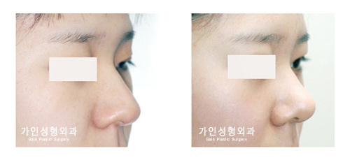 긴코-화살코