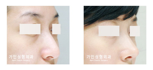 긴코-화살코