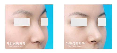긴코-화살코