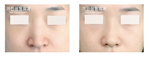 긴코-화살코