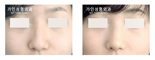 긴코-화살코