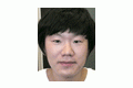 (남성) 절개법, 코성형