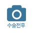 수술전후